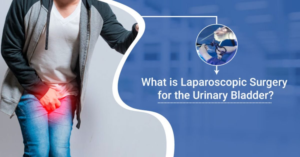 Laparoscopic Surgery for the Urinary Bladder
