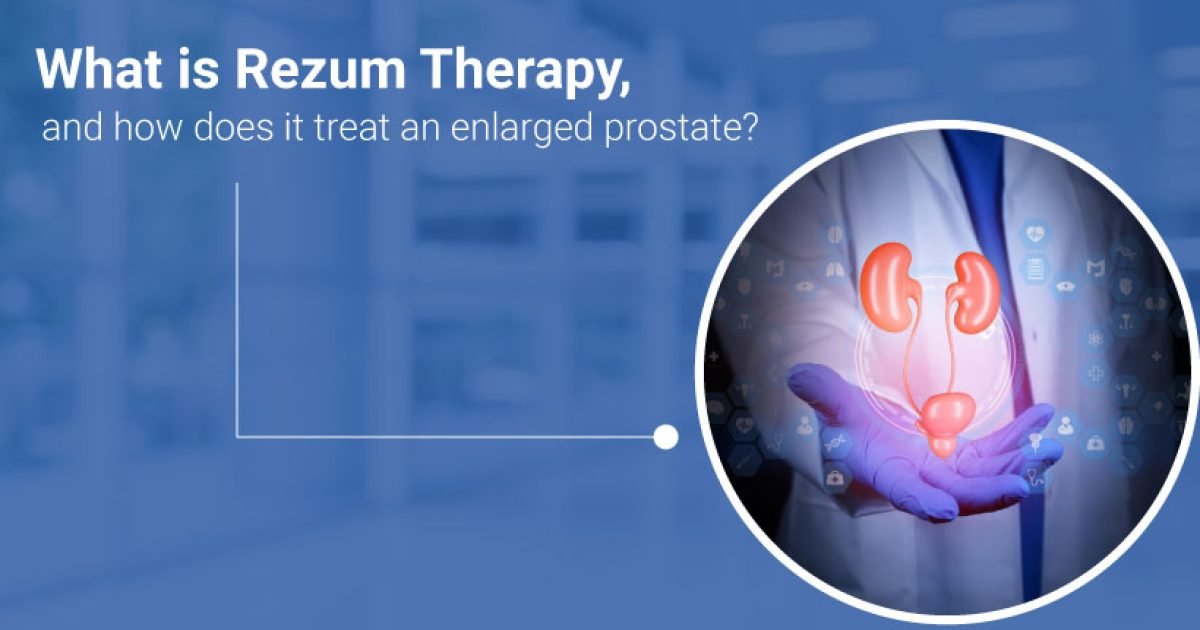 Rezum therapy for an enlarged prostate