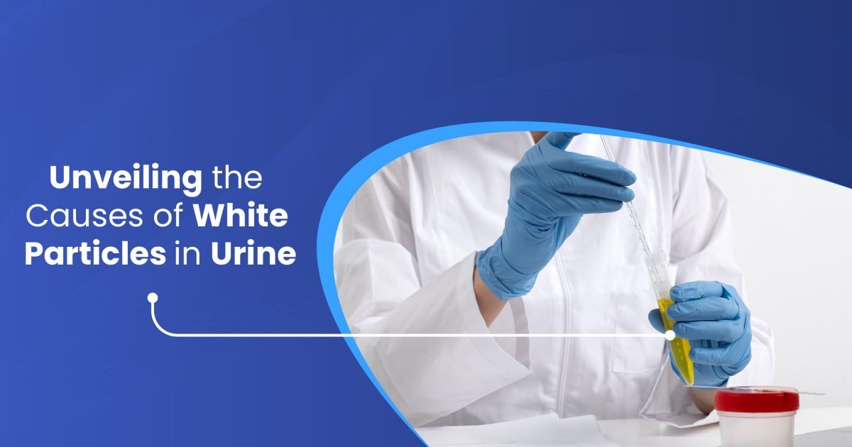 White Particles in Urine and Their Causes