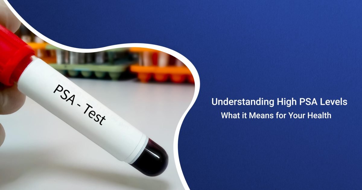 prostate-specific antigen