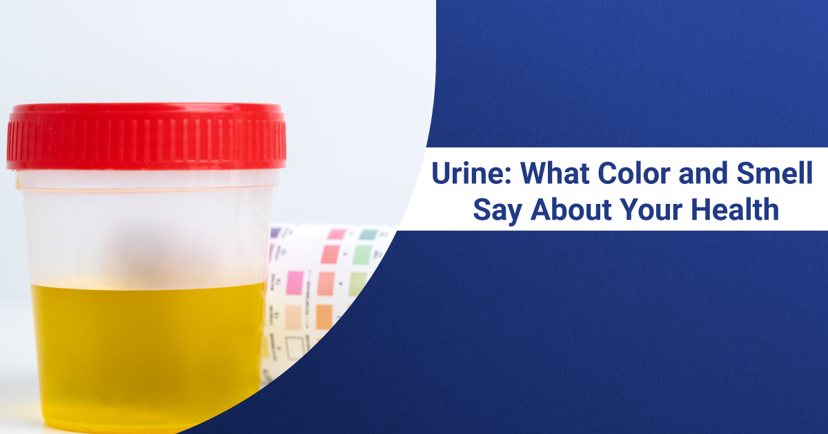 urine color