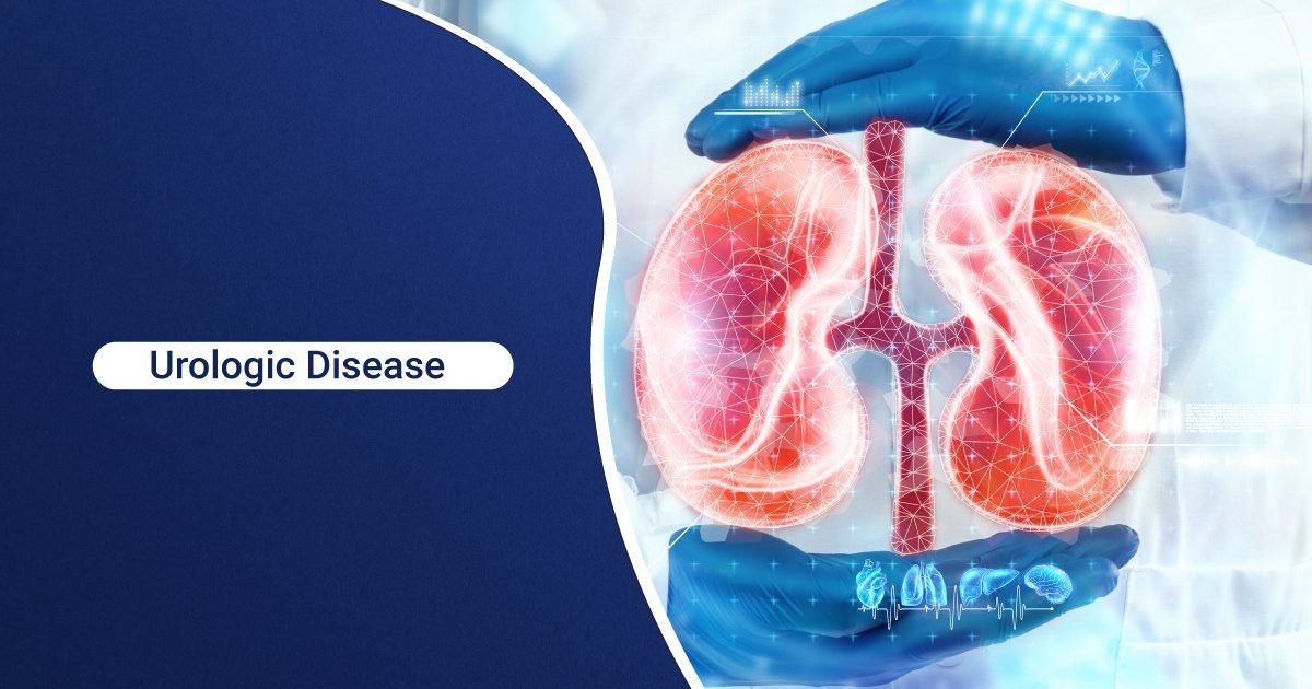 urologic diseases