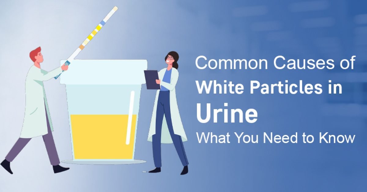 white particle in urine